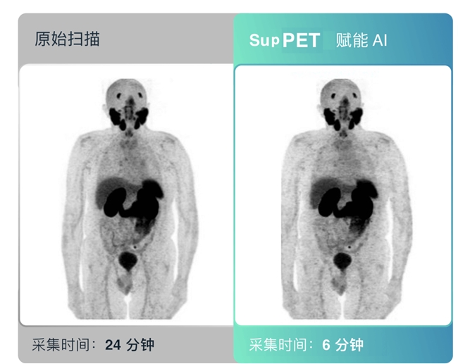 深智透医AI医学影像增强产品SupMR、SupPET获欧盟新规首证